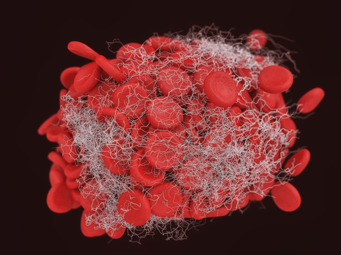 Use of local pro-coagulant haemostatic agents for intra-cavity control of haemorrhage after trauma