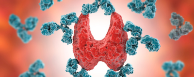 Proof-of-concept and Randomized, Placebo-controlled Trials of an FcRn Inhibitor, Batoclimab, for Thyroid Eye Disease